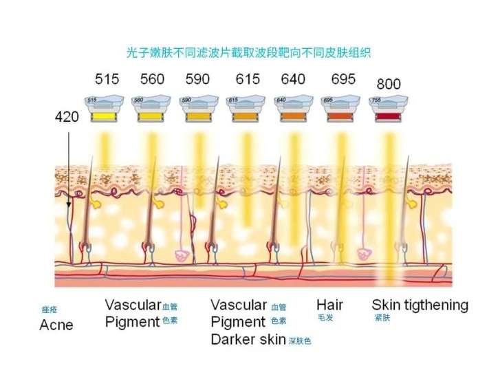 五大光子嫩膚技術(shù)（IPL、DPL、OPT、APT、BBL）及濾光片區(qū)別